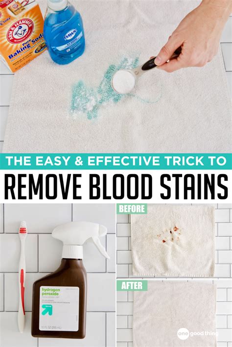 how to make fake blood stains on clothes|removing blood with hydrogen peroxide.